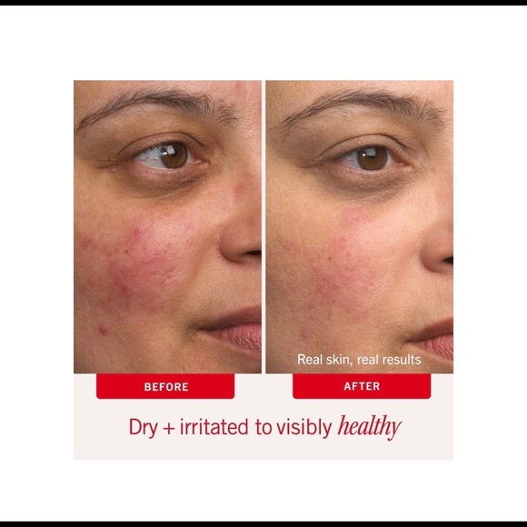 First Aid Beauty Ultra Repair Cream - Picture 5 of 9